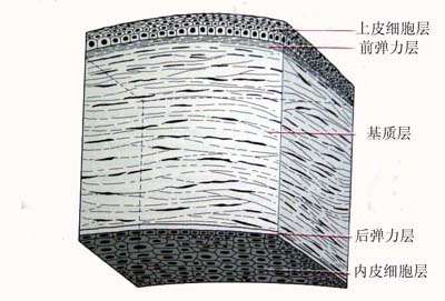 在角膜的解剖和生理角膜从结构上可分为5层:上皮细胞层,前弹力层,基质