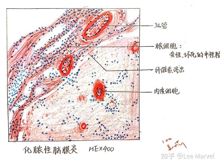 为什么咱们不弄个病理红蓝手绘图的问题呢?