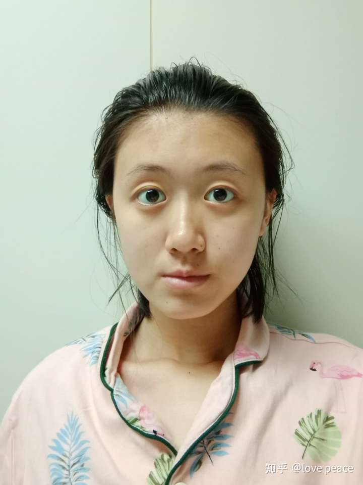 你见过蒜头鼻的美女吗?