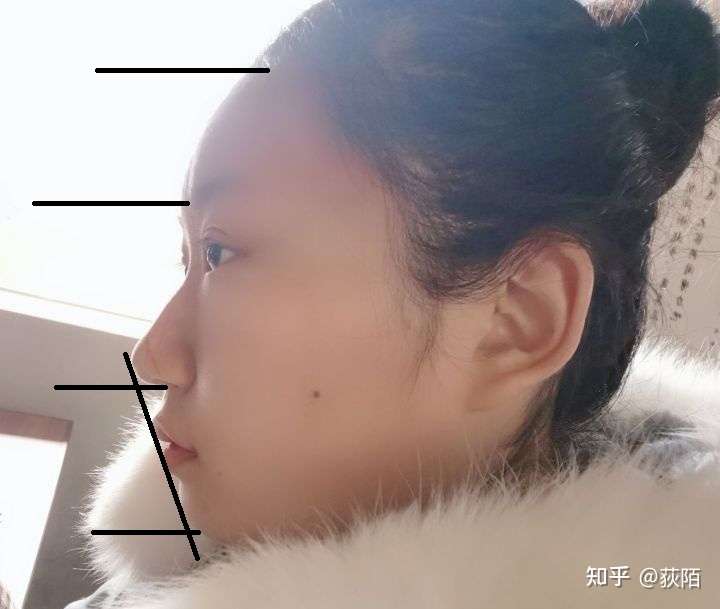 感觉正脸还行,为什么侧脸好奇怪?