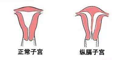 其实,并不是所有的子宫畸 形都会影响生育的,能不能生孩子,还需要看