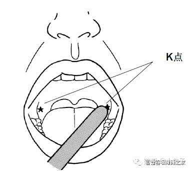 k-point位于磨牙后三角的高度,腭舌弓和翼突下颌帆的中央位置,位于两