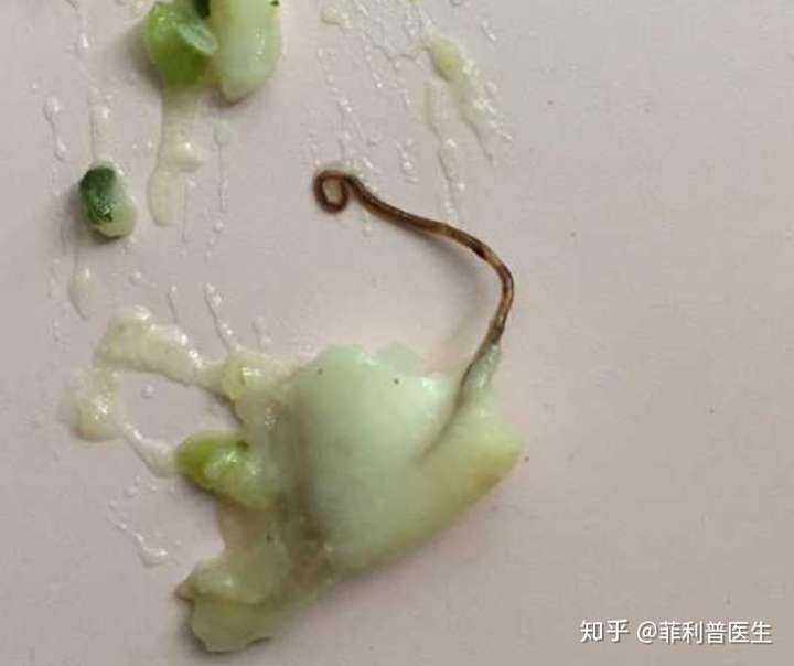 这是进口的黑鳕鱼肉里面的,不像血管,有尾部,请问是寄生虫吗?