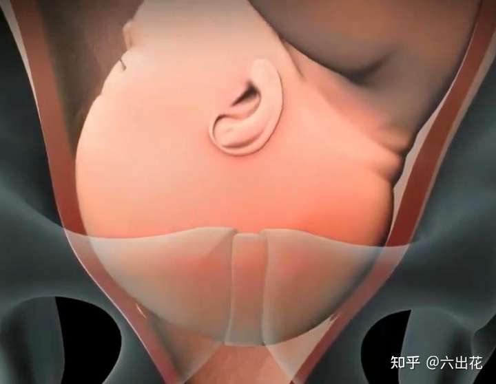 图片来源于网络,侵删 胎儿入盆给孕妇的感觉就是:整个腹部下坠,因为