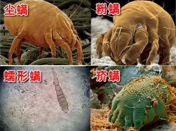 蠕形螨又叫毛囊虫,顾名思义是生活在人和哺乳动物的毛囊和皮脂腺内的