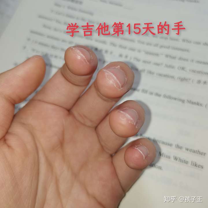 大家弹吉他的手指都是什么样的?