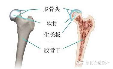 【健康科普】如何预防股骨头坏死 北京骨科医院