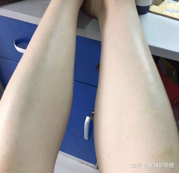 轻轻一擦,毛毛就全没有了,脱得特别的干净,感觉都不是我自己的腿了,没