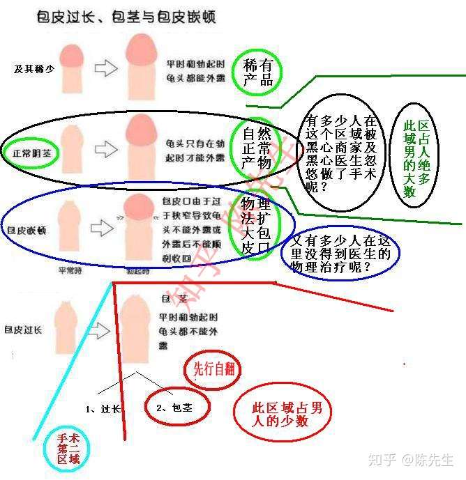 本人17,中学才知道自己是包茎也有可能是包皮过长,现在发育很差,瞒了