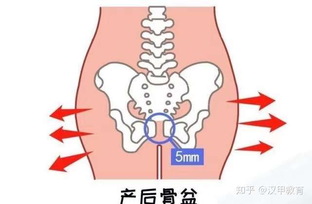 汉甲教育 耻骨分离又叫耻骨联合分离症是指骨盆前方两侧耻骨纤维