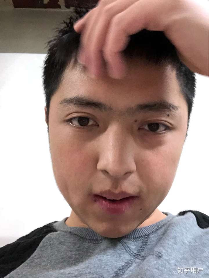 厚嘴唇塌鼻子单眼皮的男生还有救吗