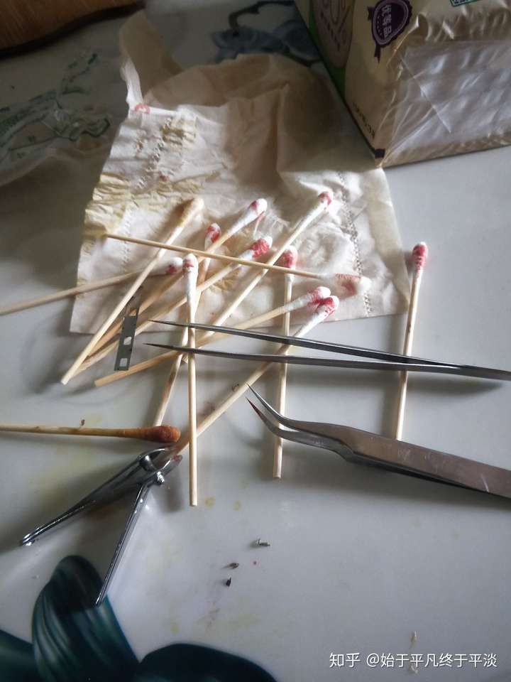 包皮手术后怎样自己拆线?