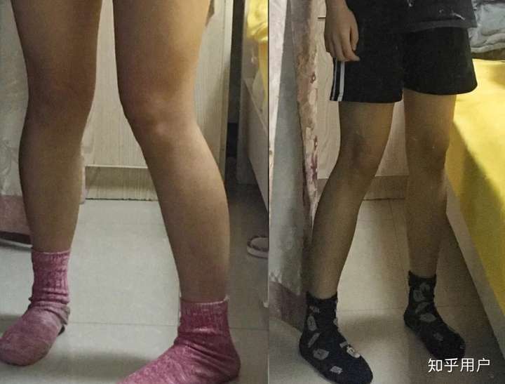 有什么很绝的瘦腿方法?