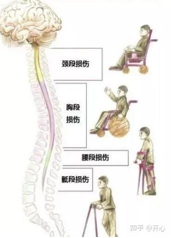 脊髓损伤恢复的症状看看你有吗?