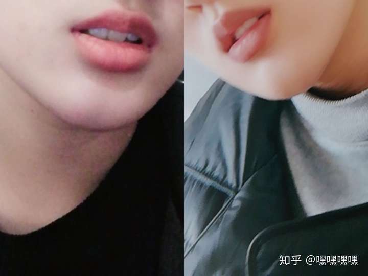 女生有个屁股下巴是种怎样的体验?