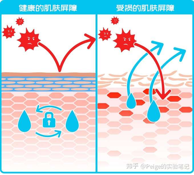 皮肤屏障受损怎么修复?