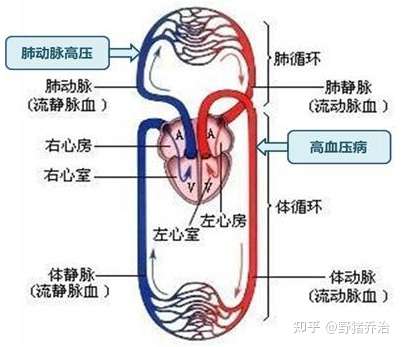 肺动脉高压(pulmonary hypertension,ph)是指由多种异源性疾病(病因)