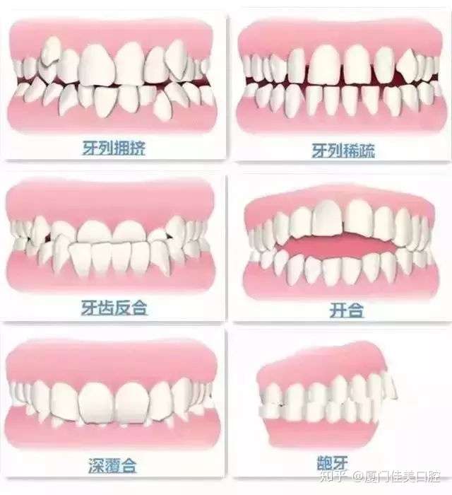 门牙是哪几颗 zhuanlan.zhihu.com