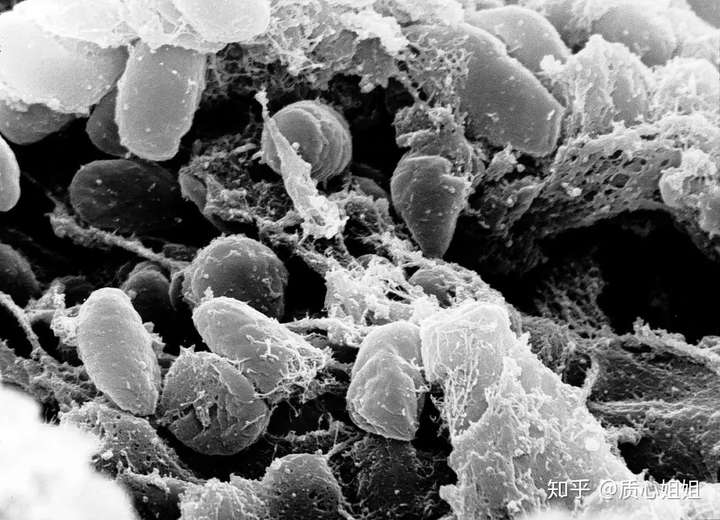 (鼠疫耶尔森菌扫描电镜照片,来源https://en.wikipedia.