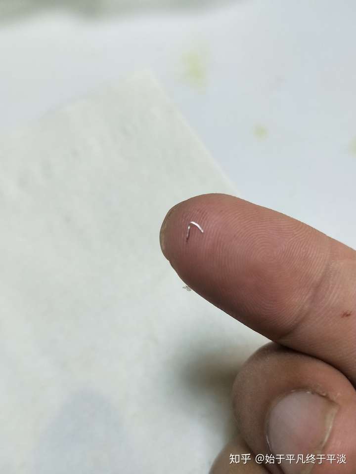 包皮手术后怎样自己拆线?