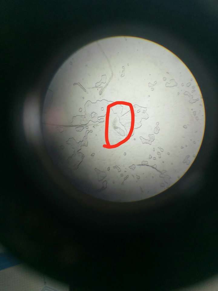 寄生虫实验课时在显微镜下看到的,再放大倍数还可以看到螨虫的几个