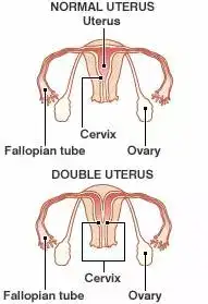 女性双子宫是怎么产生的与常人不同在哪性生活中应注意哪些