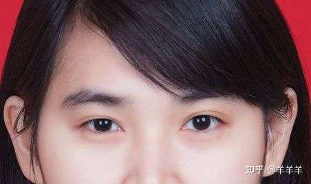 女孩子大小眼怎么办?