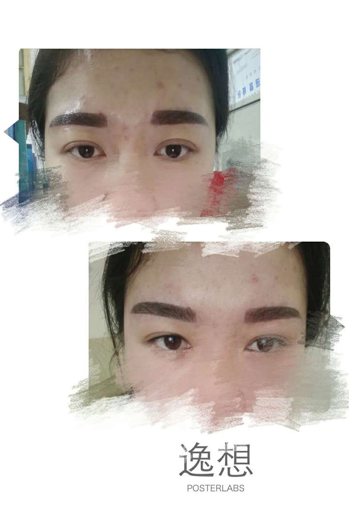 丝雾眉,刚做有点粗,结痂后会细点吗?