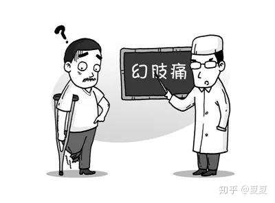 截肢后的幻肢痛在这里都有解答不要再交智商税了