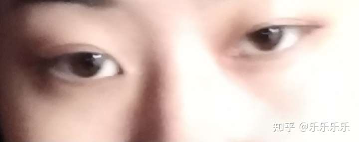 抑郁的人眼神都很空洞吗?