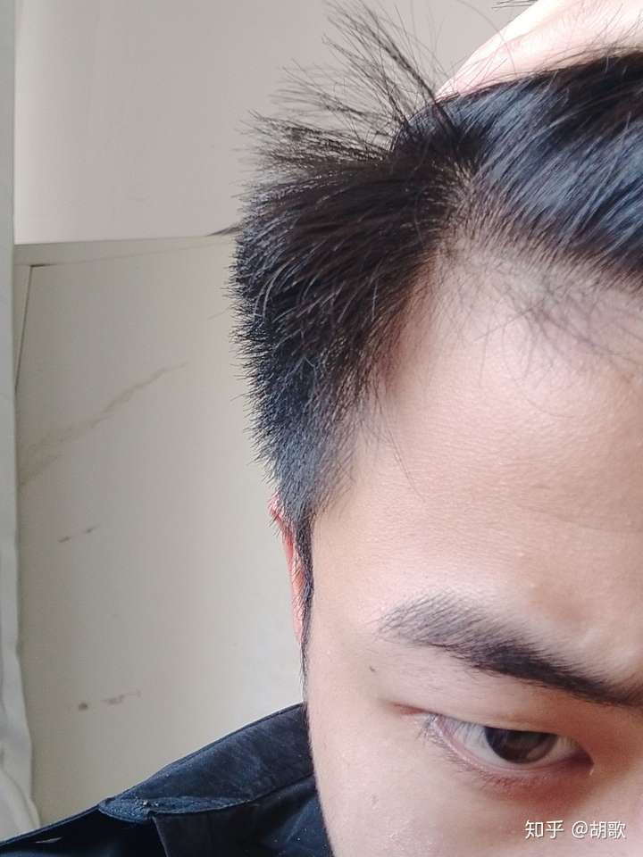 男生两侧的头发特别硬,我该怎样解决,去理发店软化头发可行么?