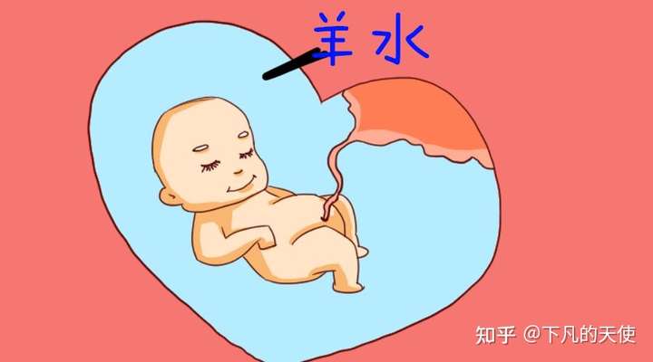 孕期羊水量的正常范围量是多少?