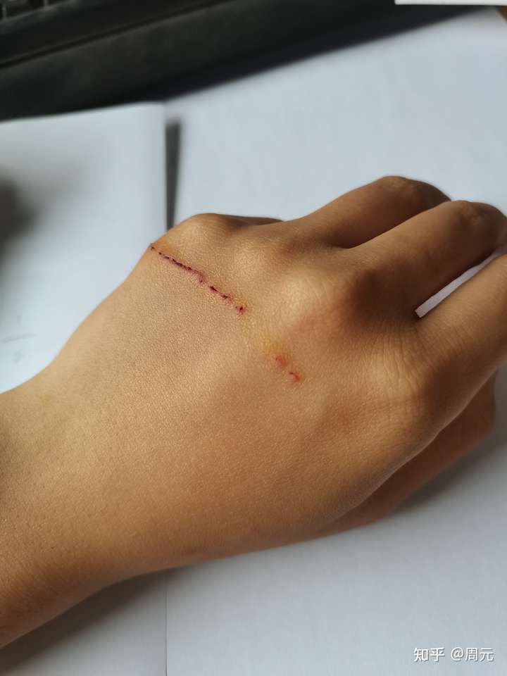 被猫狠狠的抓伤是一种什么样的体验