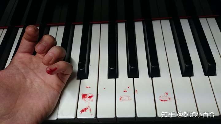 弹钢琴练八度,小拇指出血了正常吗.