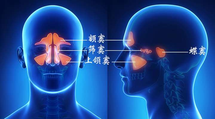 鼻窦的位置,鼻道部位慢性黏膜炎症称为鼻炎