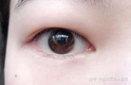 肿眼炮加内双可以通过怎样的方法变大变好看