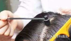 七星梅花针生发界的物理神器