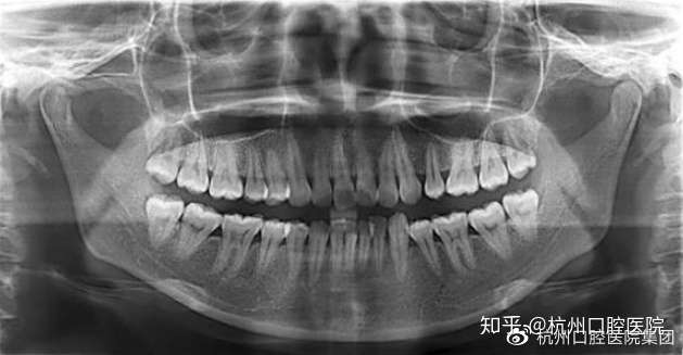 看牙为啥要拍片拍片是浪费时间浪费金钱