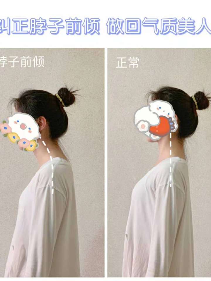 脖子前倾怎么矫正