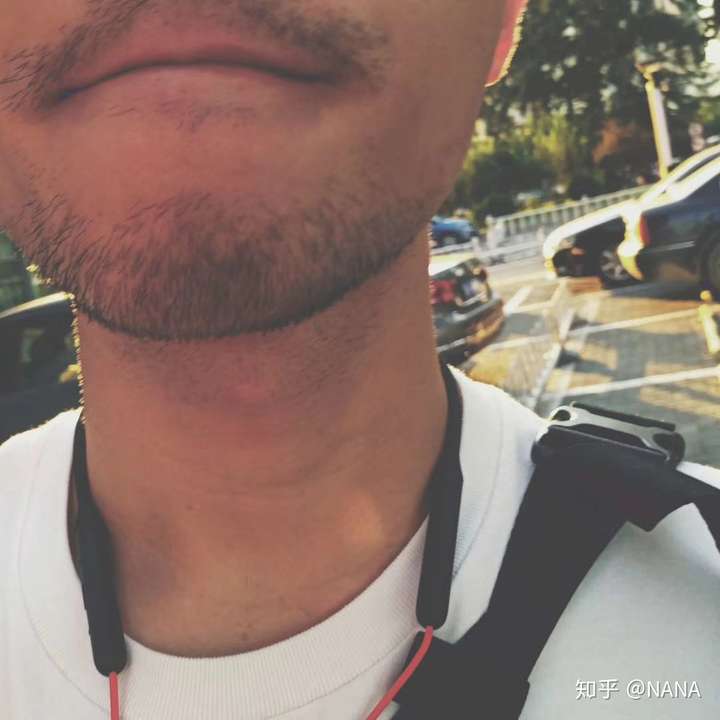 初中以前不敢穿短裤,因为那会别人腿毛都没有的时候,我腹毛已经连成