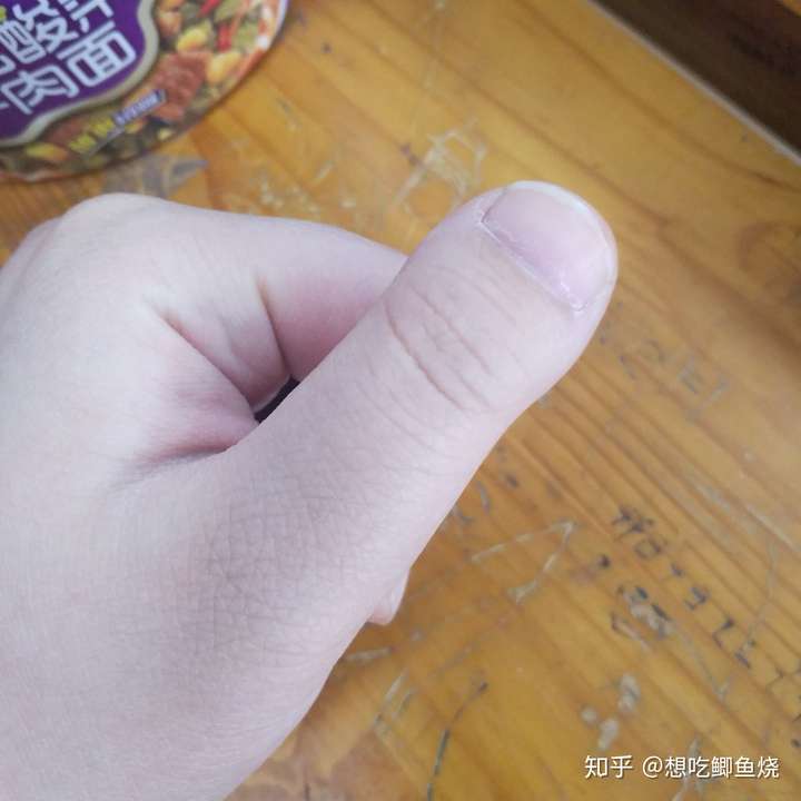 我的拇指也是宽短粗,从小被说到大,甚至被亲妈嫌弃哈哈哈,每回朋友