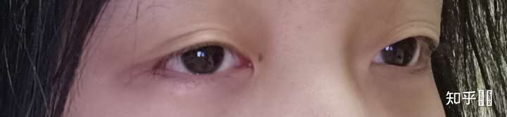 抑郁的人眼神都很空洞吗?