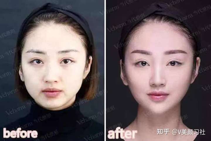 大小脸/脸不对称要看哪一科!救命啊呜呜呜呜!