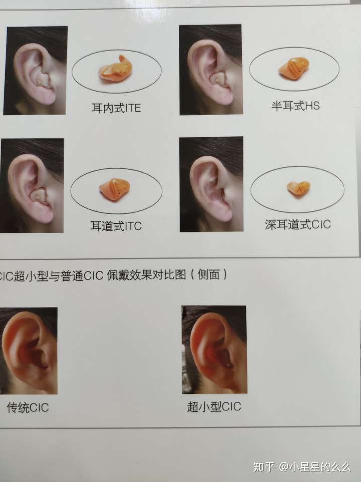 定制式助听器有什么优点?