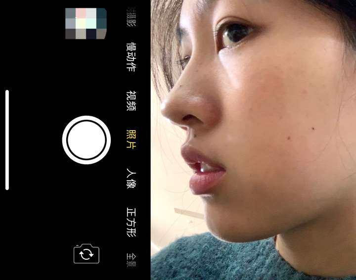 侧脸扁平是不是容易老?