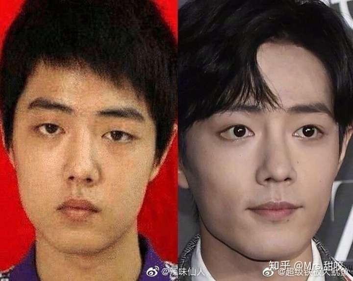 为什么肖战变丑了?