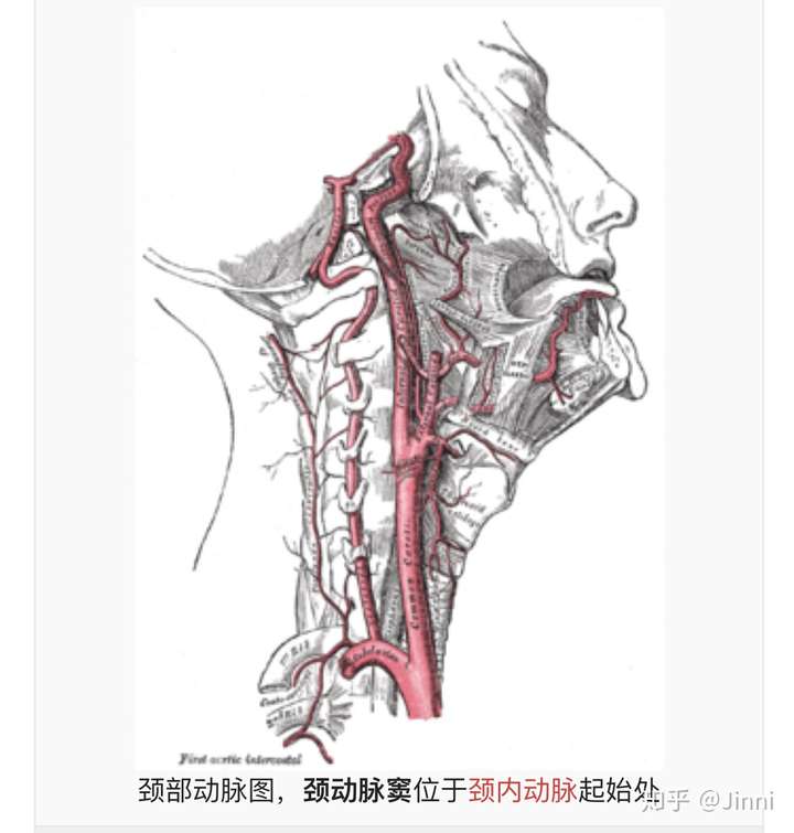 是因为颈动脉神经密集处受到外界压力,导致颈动脉窦性晕厥,或有血管