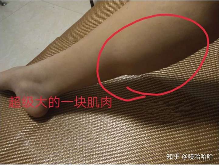 肌肉腿怎么瘦?