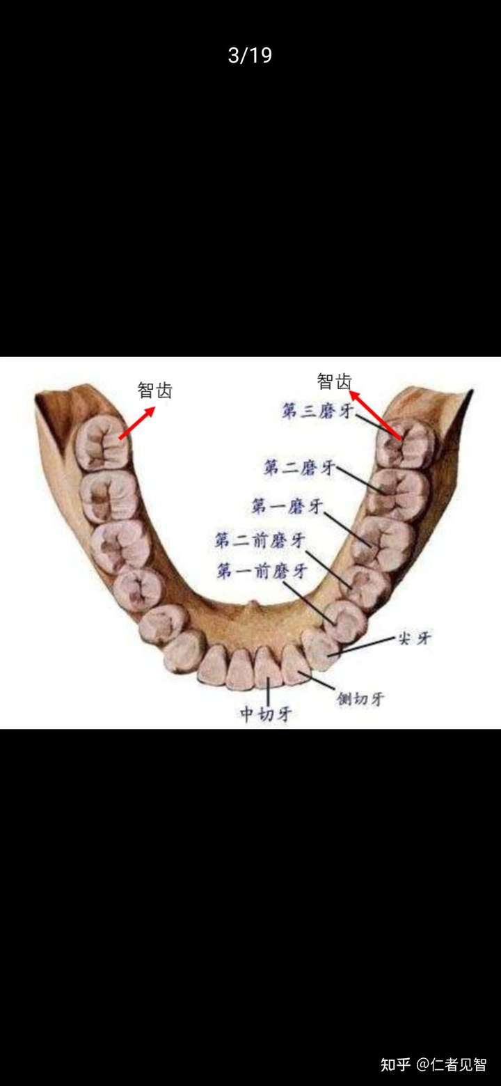 三磨牙,因在人的智力发育旺盛时期(平均为17～21岁)萌出,故亦称智牙