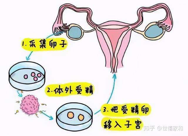 胚胎移植到子宫,首先手术前要求膀胱适当充盈,在b超引导下移植,实验